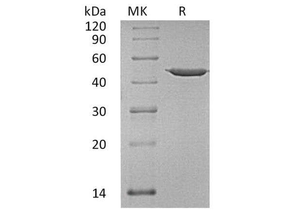 Human Annexin A7/ANXA7 Recombinant Protein (RPES2727)