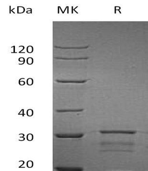 Human IPPI2/IDI2 Recombinant Protein (RPES2729)