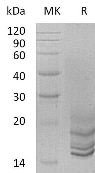 Progonadoliberin-2/GNRH2 Recombinant Protein (RPES2730)