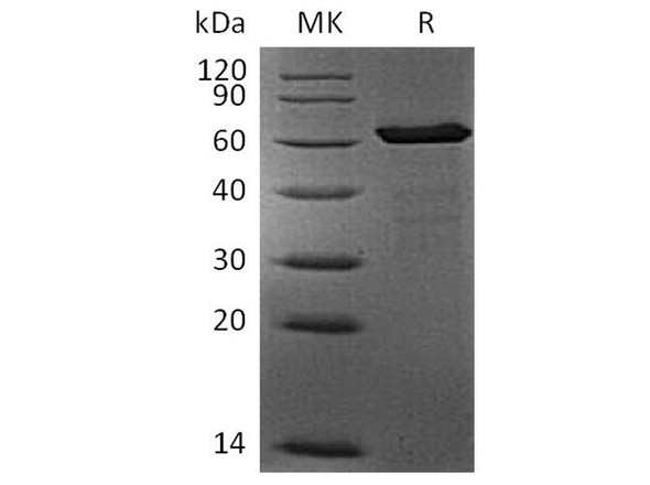 Human FGL1 Recombinant Protein (RPES2737)