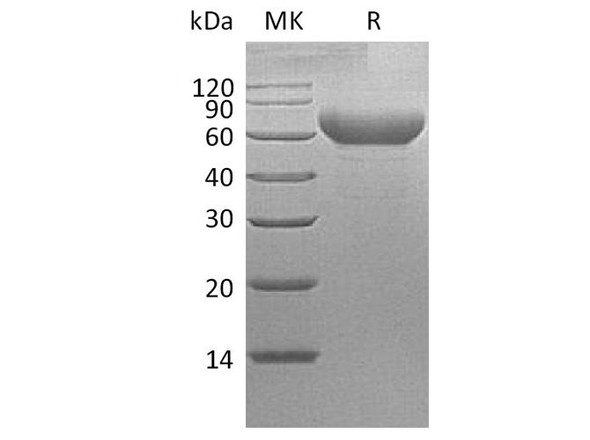 Cynomolgus TIM-3/HAVCR2 Recombinant Protein (RPES2738)