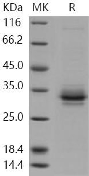 Human FOLR2/FBP Recombinant Protein (RPES2741)