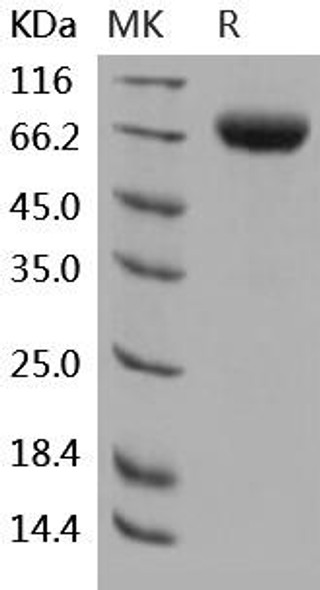 Human 2B4/CD244 Recombinant Protein (RPES2743)