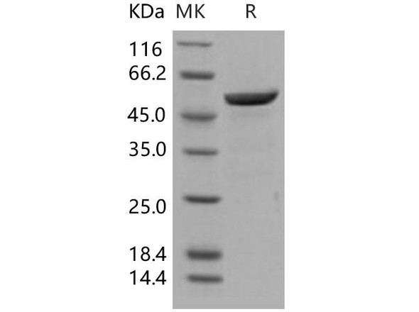Human 14-3-3 beta/YWHAB Recombinant Protein (RPES2746)