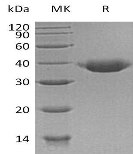 Human JAM-B/CD322 Recombinant Protein (RPES2749)