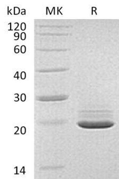 Human PRAP1 Recombinant Protein (RPES2750)