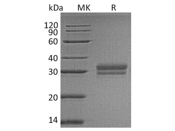 Human VSIG2 Recombinant Protein (RPES2756)