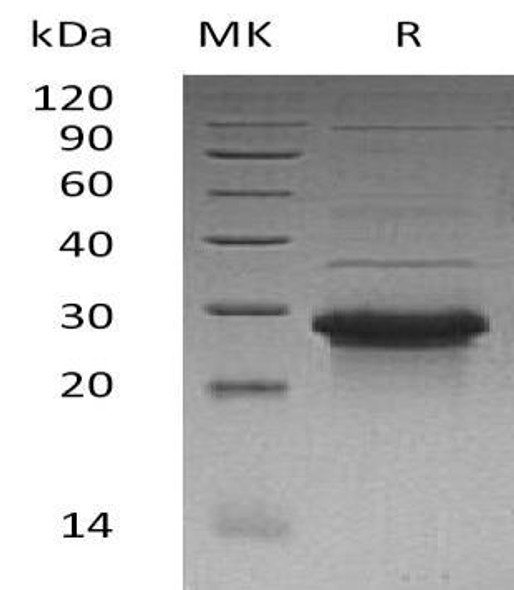 Human WBP1 Recombinant Protein (RPES2789)