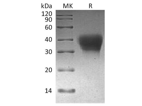 Cynomolgus PD/CD279/PDCD1 Recombinant Protein (RPES2796)