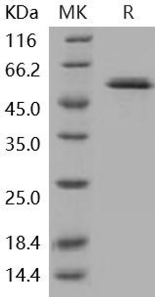 Human Glucokinase/GCK Recombinant Protein (RPES2803)