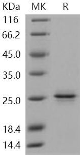 Human PRDM2/RIZ1 Recombinant Protein (RPES2819)