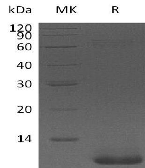 Pro-Neuregulin/NRG1-beta 1 Recombinant Protein (RPES2828)