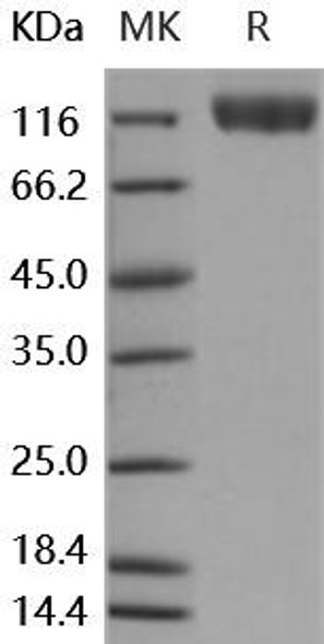 Human VEGFR2/Flk/KDR Recombinant Protein (RPES2841)