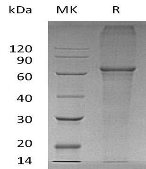 Human XPNPEP3 Recombinant Protein (RPES2850)