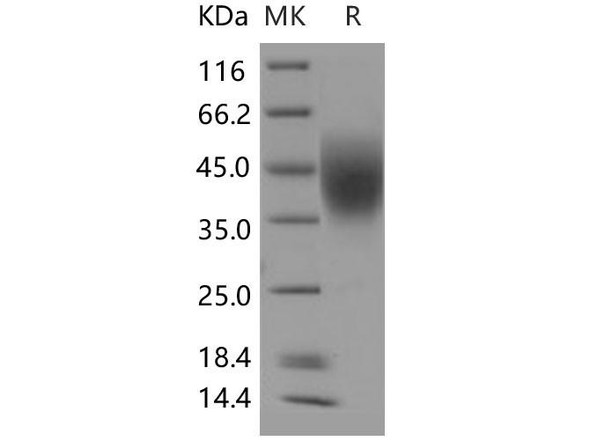 Human LFA-3/CD58 Recombinant Protein (RPES2859)