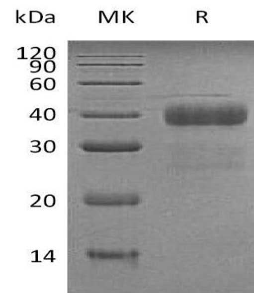 Human Kallikrein 5/KLK5 Recombinant Protein (RPES2869)