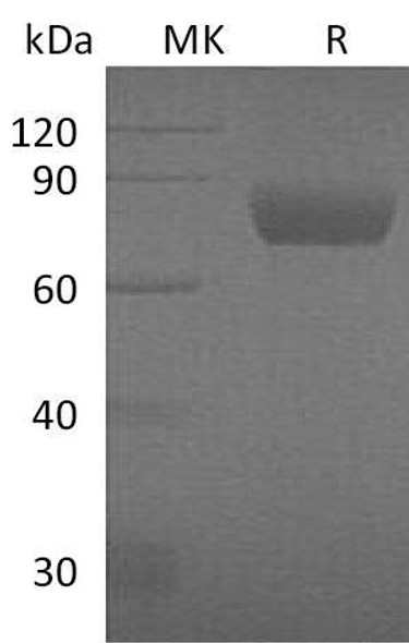 Mouse SerpinD1/HCF2 Recombinant Protein (RPES2873)