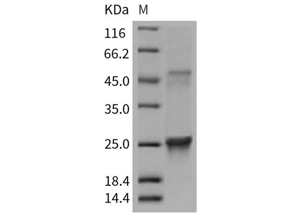 Mouse GLO1/Glyoxalase 1 Recombinant Protein (RPES2914)