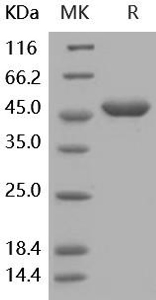 Human G-CSF/CSF3 Recombinant Protein (RPES2924)