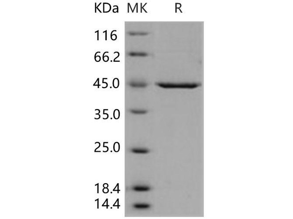 Human PDK Recombinant Protein (RPES2941)