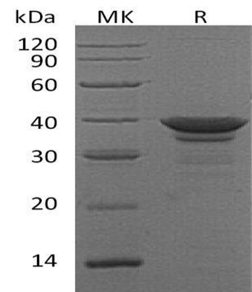 Human Arginase/ARG1 Recombinant Protein (RPES2985)