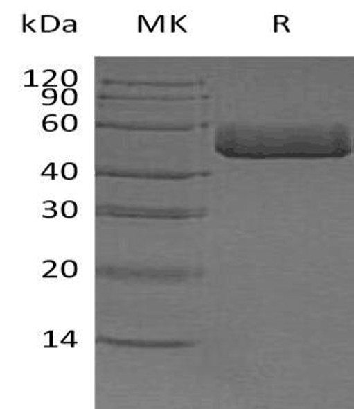 ACPP Recombinant Protein (RPES2988)