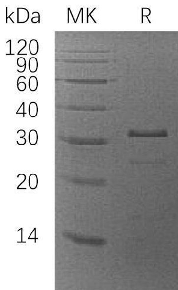 Human ZMYND19 Recombinant Protein (RPES2989)