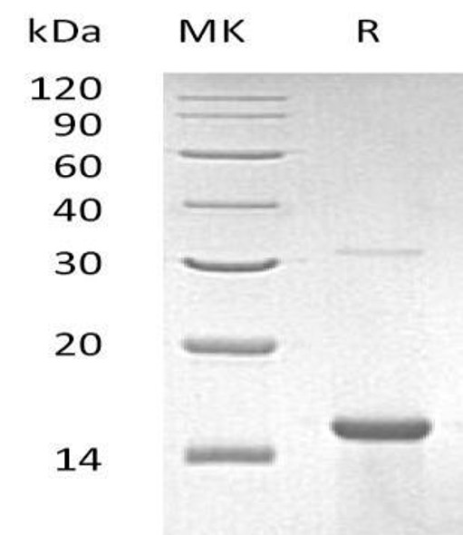 Human ZNF100 Recombinant Protein (RPES3006)