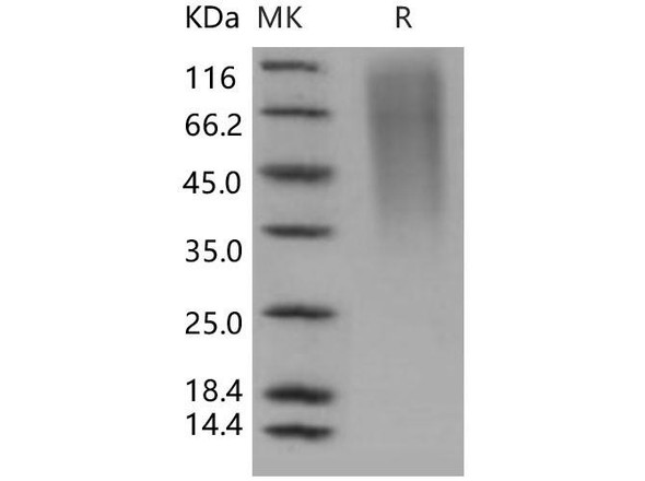 Human CD164/Endolyn Recombinant Protein (RPES3015)