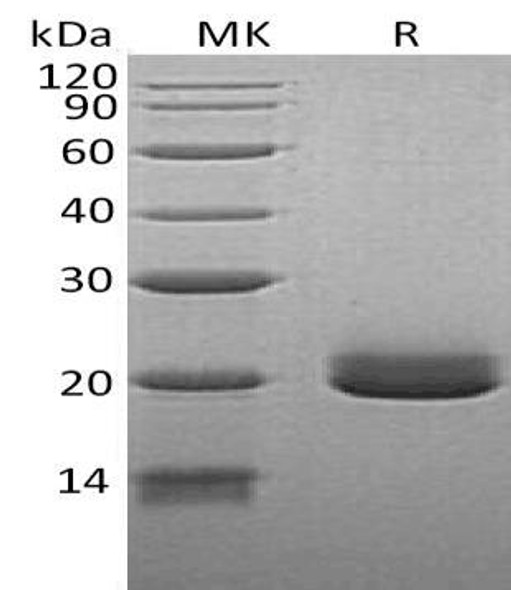 Human Ephrin-A4/EFNA4 Recombinant Protein (RPES3023)