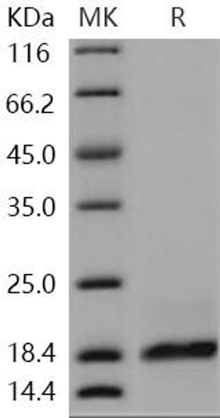 Human PLA2G2A/PLA2B Recombinant Protein (RPES3056)