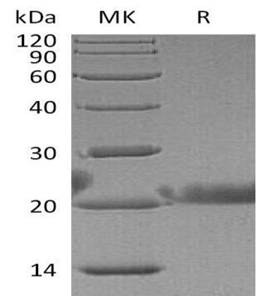 Human Lacritin/LACRT Recombinant Protein (RPES3065)