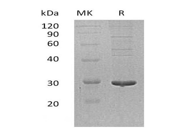 Human PDIA5 Recombinant Protein (RPES3106)