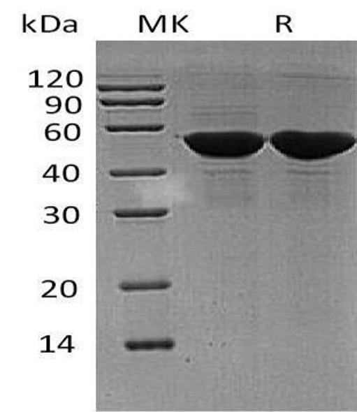 Human PDIA6 Recombinant Protein (RPES3127)