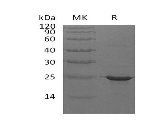 Human CRYAB Recombinant Protein (RPES3128)