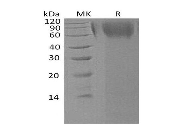 Human LAMP1/CD107a Recombinant Protein (RPES3146)