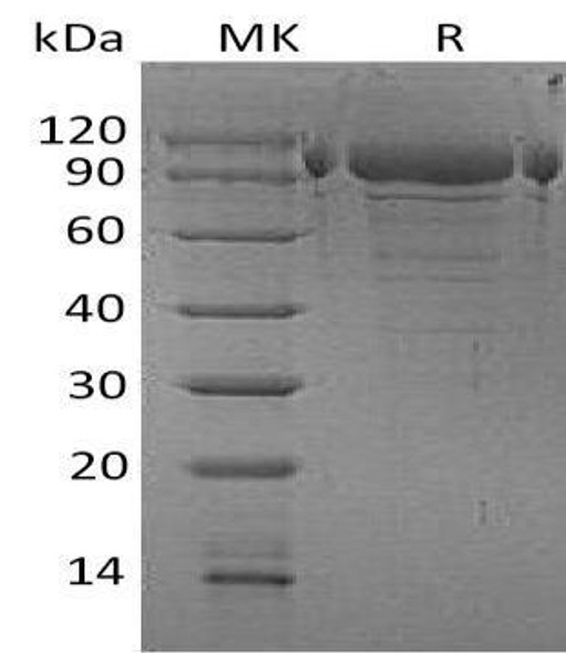 Human PDILT Recombinant Protein (RPES3147)