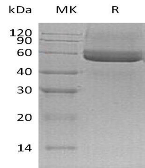 Mouse Testican-3/SPOCK3 Recombinant Protein (RPES3150)