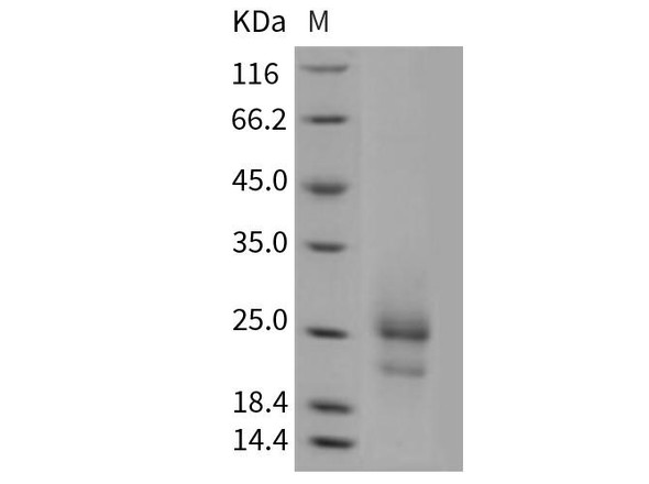 Mouse TSLP Recombinant Protein (RPES3177)