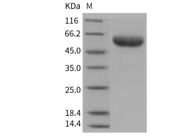 Mouse IL6RA/CD126 Recombinant Protein (RPES3178)