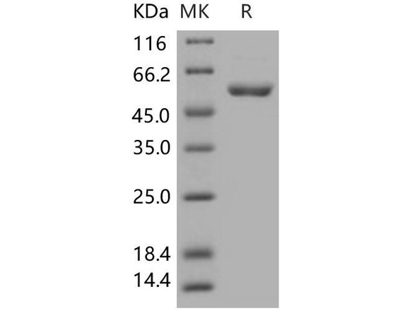 Human CDC2 Kinase/CDK1 Recombinant Protein (RPES3180)