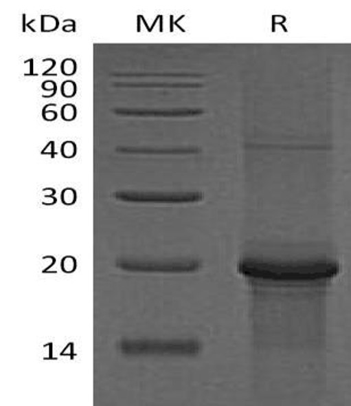 Human PKC epsilon/PKCE Recombinant Protein (RPES3223)