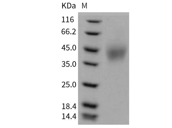 Mouse SLAMF6/Ly108 Recombinant Protein (RPES3225)