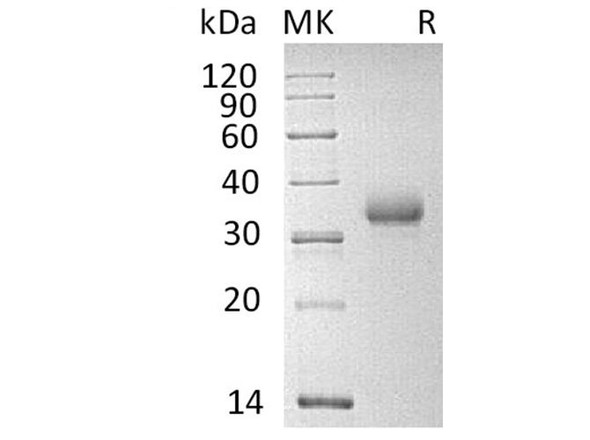 Human CD2 Recombinant Protein (RPES3229)