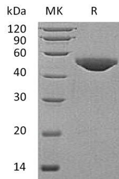 Human B4GAT1/B3GNT1 Recombinant Protein (RPES3241)