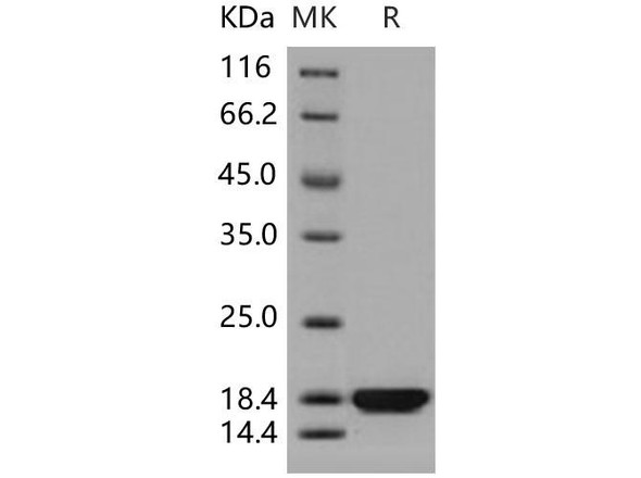 Human PDZD11/PDZK11/PISP Recombinant Protein (RPES3254)