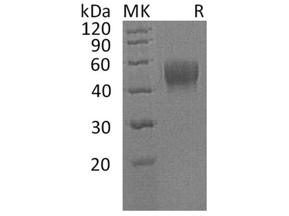 Human IL10RB/IL10R2 Recombinant Protein (RPES3271)