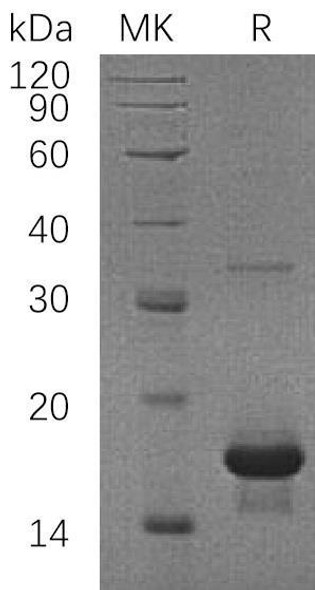 Human SH2D1A/SAP Recombinant Protein (RPES3275)