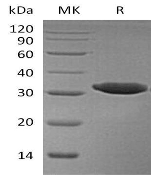 Human Esterase D/ESD Recombinant Protein (RPES3283)