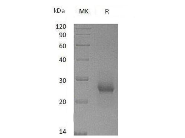 Mouse TIMP1/TIMP Recombinant Protein (RPES3288)